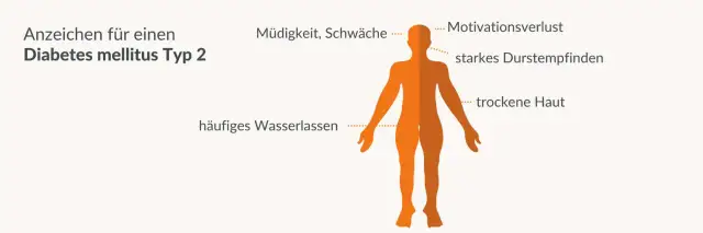 Zuckerschock Symptome: So erkennen Sie gefährliche Anzeichen rechtzeitig