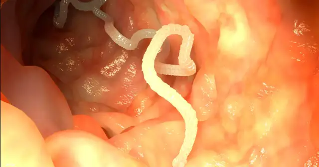 Po jakim czasie działa lek na odrobaczenie i co warto wiedzieć?