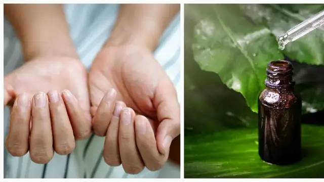 Jak stosować olejek z drzewa herbacianego na grzybicę paznokci skutecznie?