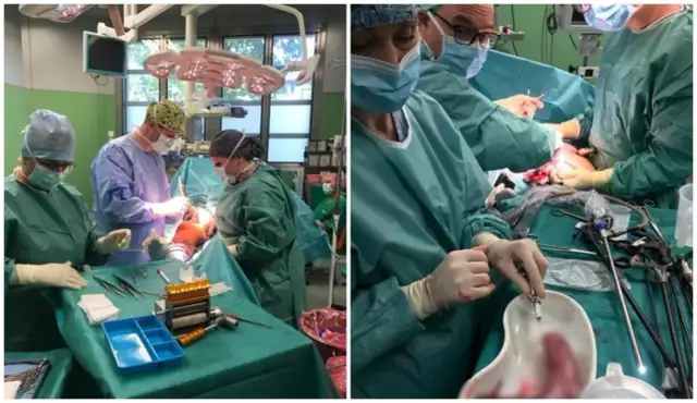 Operacja zmniejszenia żołądka nfz gdzie - sprawdź najlepsze ośrodki w Polsce