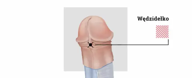 Czy kolczyk w wędzidełku boli? Poznaj prawdę o bólu i gojeniu