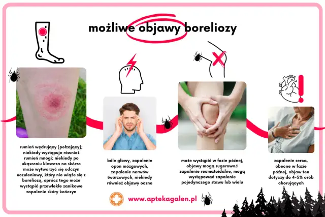 Borelioza objawy psychiczne: jak choroba wpływa na zdrowie psychiczne i co robić