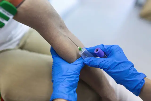 Pobieranie krwi do badań. Wyniki mogą wykazać eozynofile podwyższone, co może wskazywać na alergię lub pasożyty.