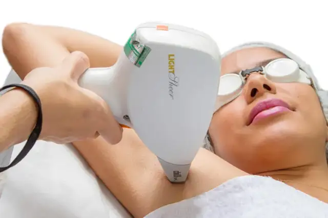 Depilacja laserowa: Bezpieczna? Mity, fakty i jak uniknąć ryzyka