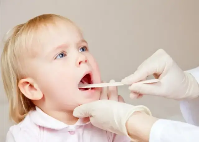 Jak rozpoznać ból gardła u niemowlaka – objawy, które musisz znać