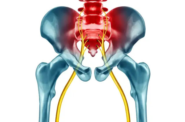 Jakie badania są potrzebne przy rwie kulszowej, aby uniknąć bólu?