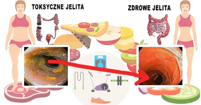 Jak odbudować jelita? 7 skutecznych sposobów na zdrowy mikrobiom