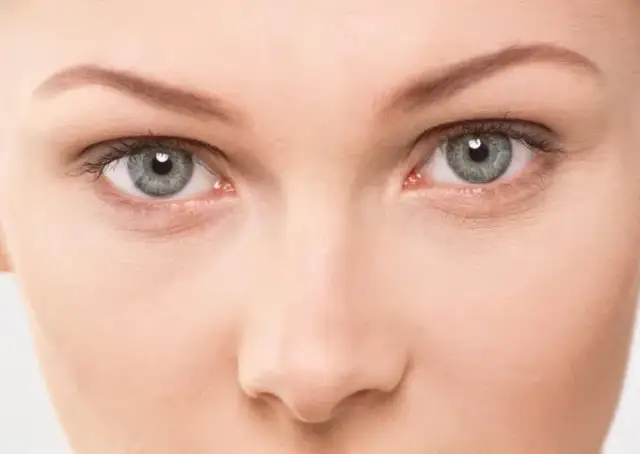 Leniwe oko jak wygląda: objawy, które mogą cię zaniepokoić