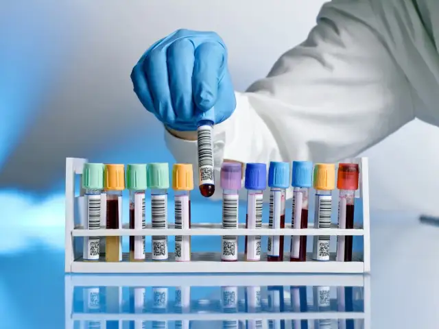Ile jest ważne skierowanie na badania krwi? Wszystko, co musisz wiedzieć