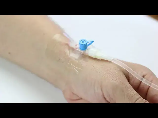 Jak podłączyć kroplówkę instrukcja - uniknij najczęstszych błędów