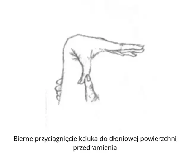 Wiotkość stawów – do jakiego lekarza się udać i jak rozwiązać problem?