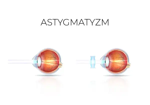 Jak pozbyć się wady wzroku i odzyskać lepsze widzenie bez bólu