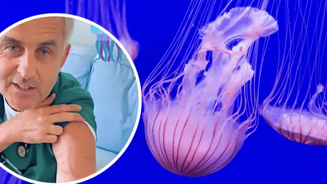 Czy meduzy w Bałtyku są groźne? Sprawdź, jakie mogą być konsekwencje