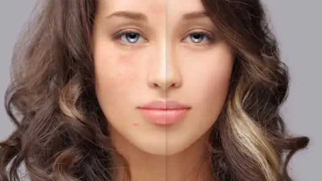 Cera tłusta czego unikać: najgorsze składniki dla Twojej skóry