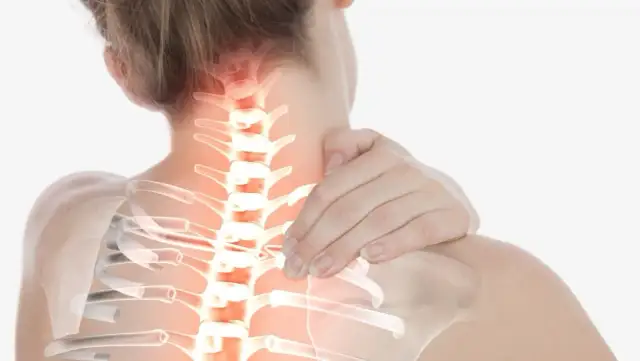 Músculos del cuello inflamados: Alivio, causas y cuándo ir al médico