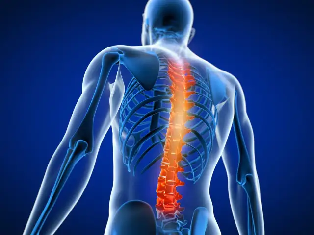 Objawy raka kręgosłupa: Kiedy ból pleców to sygnał alarmowy?