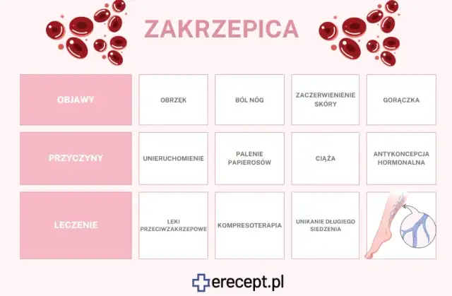 Zakrzepica: Jakie leki wybrać? Opcje, zasady i bezpieczeństwo