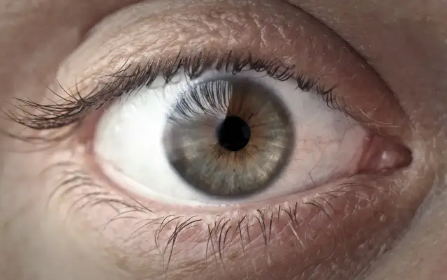 Jaskra: Cichy złodziej wzroku. Jak rozpoznać pierwsze objawy?