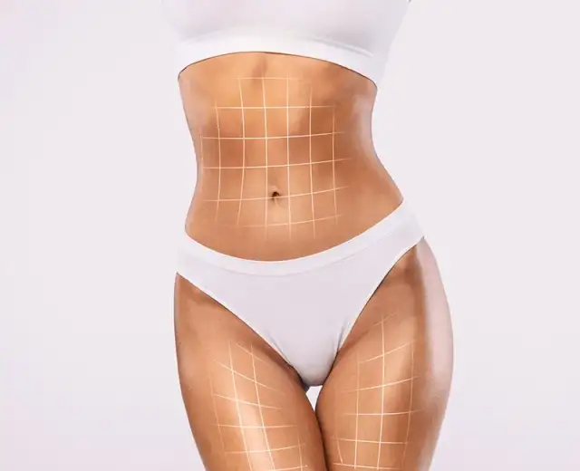 Liposukcja gdzie najlepiej: wybierz najlepsze kliniki w Polsce