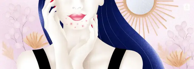 Od czego są pryszcze na brodzie? Odkryj nieznane przyczyny i skutki