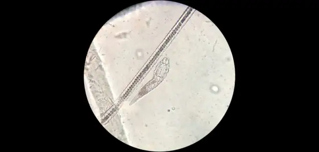 Jak stosować olejek herbaciany na nużeńca, aby skutecznie leczyć skórę