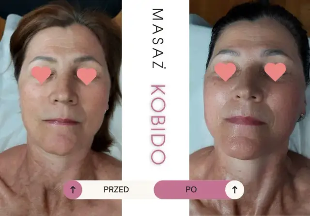 Masaż Kobido jak długo efekty? Odkryj, co warto wiedzieć o trwałości rezultatów