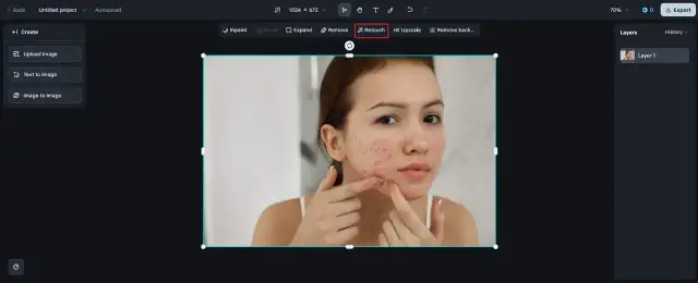 Jak szybko usunąć pryszcz? Skuteczne metody na natychmiastowe efekty