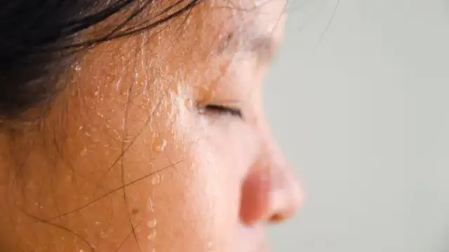 Czego objawem jest pocenie się głowy? Przyczyny i skutki nadpotliwości