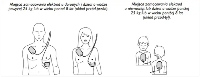 AED: Kiedy NIE używać? Sprawdź przeciwwskazania i mity