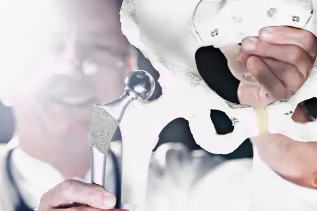 Gdzie najszybciej na endoprotezę stawu biodrowego NFZ z krótkim czasem oczekiwania