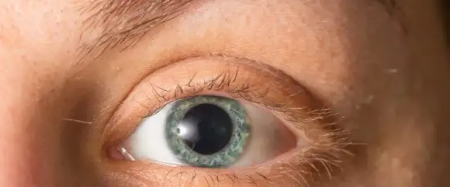 Po kroplach rozszerzających źrenice: kiedy można prowadzić auto?