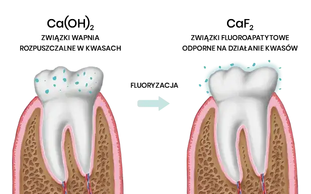 Objawy niedoboru fluoru: jak rozpoznać zagrożenie dla zdrowia zębów