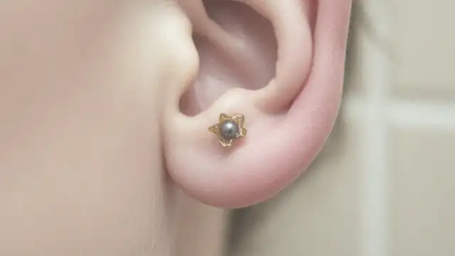 Ropiejące ucho od kolczyka: Szybka pomoc i skuteczne sposoby leczenia