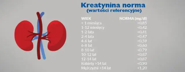 Podwyższony poziom kreatyniny w surowicy krwi - co to oznacza dla zdrowia?