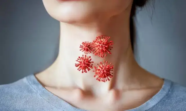 Skuteczne leki na anginę ropną bez recepty, które złagodzą ból gardła