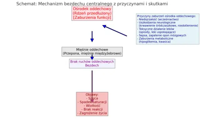 Bezdech senny przyczyny: Jak uniknąć poważnych zagrożeń zdrowotnych