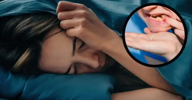 Czy wypadające zęby zawsze oznaczają śmierć? Odkryj prawdziwe znaczenie snu