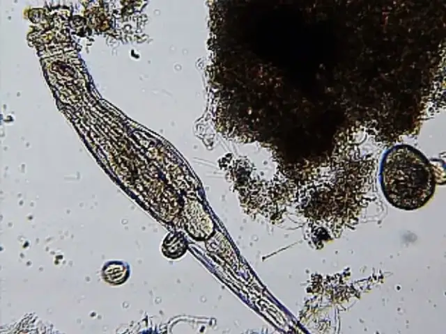 Skratki z oczyszczalni ścieków: Kto je odbiera i co się z nimi dzieje?