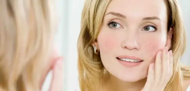 Najlepszy kolor włosów do cery naczynkowej: ukryj zaczerwienienia