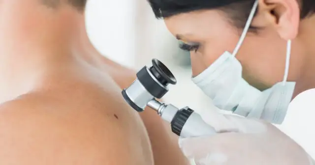 Jak zapobiec wznowie raka: skuteczne strategie i porady zdrowotne