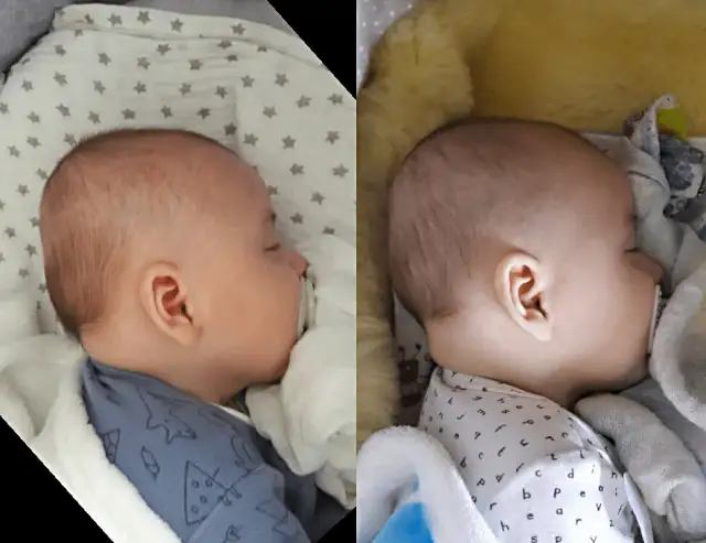 Poduszka kształtująca główkę od kiedy - uniknij deformacji czaszki dziecka