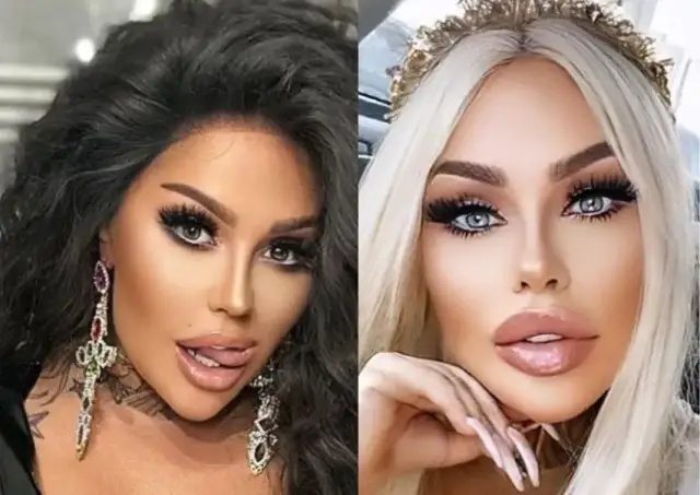 Kasia Alexander kiedyś: Szokujące zmiany w jej wyglądzie przed operacjami