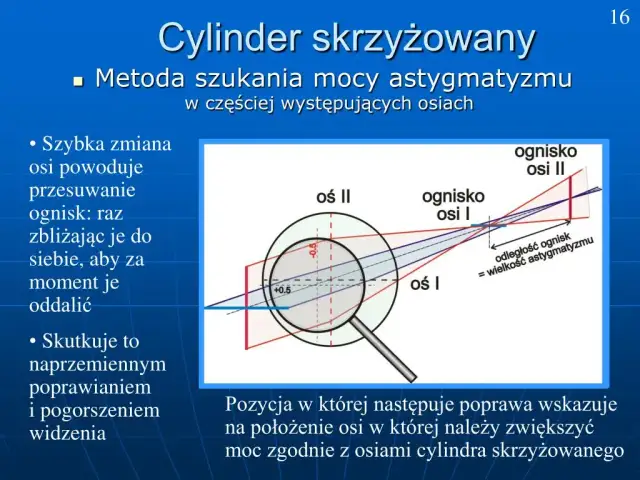 Czym jest cylinder w wadzie wzroku i jak wpływa na astygmatyzm? Wyjaśniamy prosto!