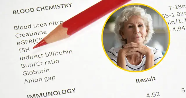 TSH: Co to za badanie? Interpretuj wyniki jak ekspert!