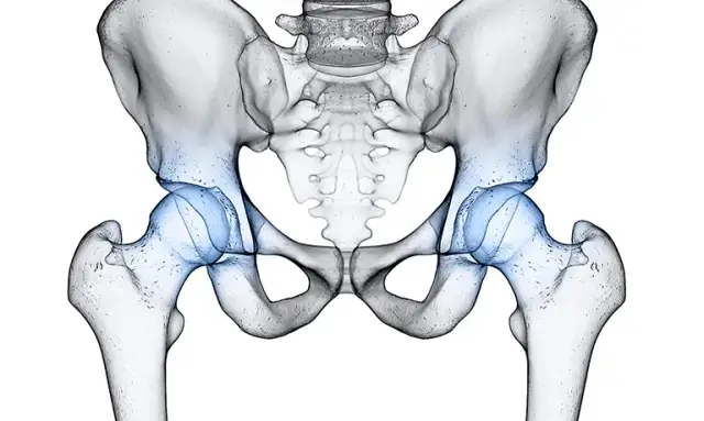 Endoproteza stawu biodrowego NFZ - gdzie najszybciej bez czekania