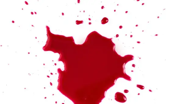 Krew w snach: odkryj znaczenie snu i jego tajemnice