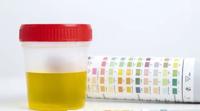 Monural: Kiedy zrobić badanie moczu, by wynik był wiarygodny?