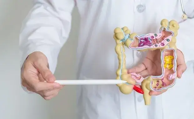 Do czego służy wyrostek robaczkowy i dlaczego jego funkcje są ważne?