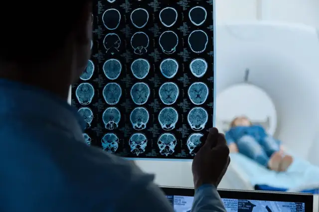 Lekarz analizuje wyniki rezonansu magnetycznego głowy bez kontrastu, szukając powikłań. W tle pacjent leży w aparacie MRI.