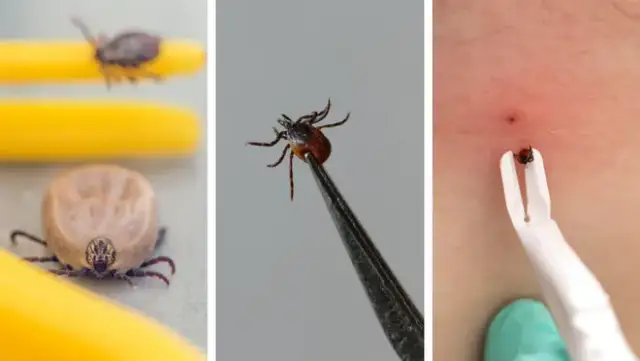 Jak usunąć kleszcza? Uniknij błędów i chroń zdrowie!